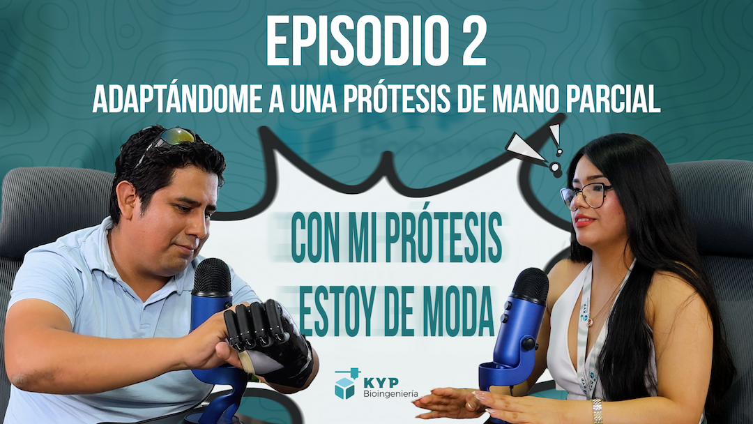 Thumbnail para Episodio 2: ADAPTÁNDOME A UNA PRÓTESIS DE MANO PARCIAL | KYP BIOINGENIERÍA